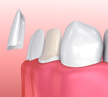 Treatment - Cambridge Street Dental