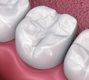 Treatment - Cambridge Street Dental